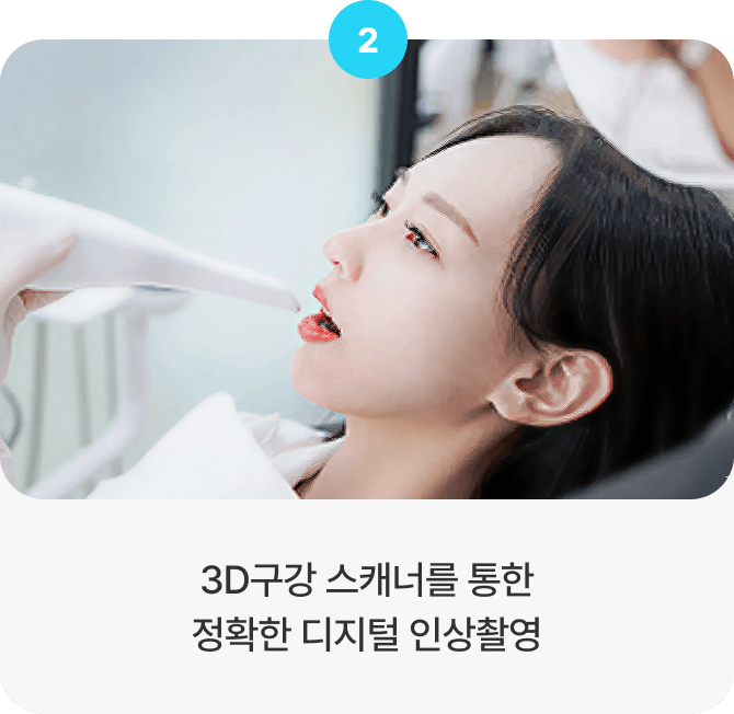 3D구강 스캐너를 통한 정확한 디지털 인상촬영