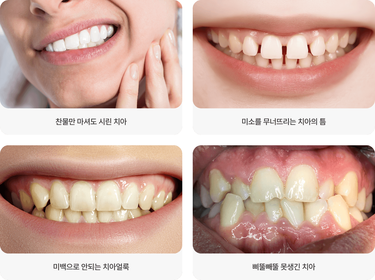 찬물만 마셔도 시린 치아, 미소를 무너뜨리는 치아의 틈, 미백으로 안되는 치아얼룩, 삐뚤빼뚤 못생긴 치아