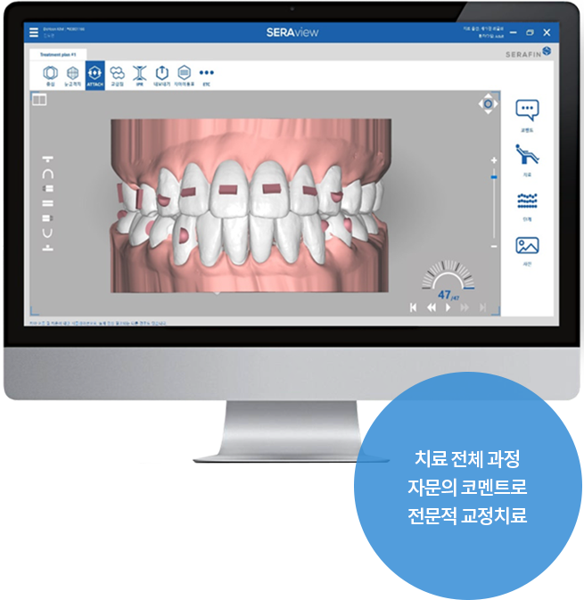 치료 전체 과정 자문의 코멘트로 전문적 교정치료